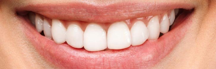 After Dental Treatment